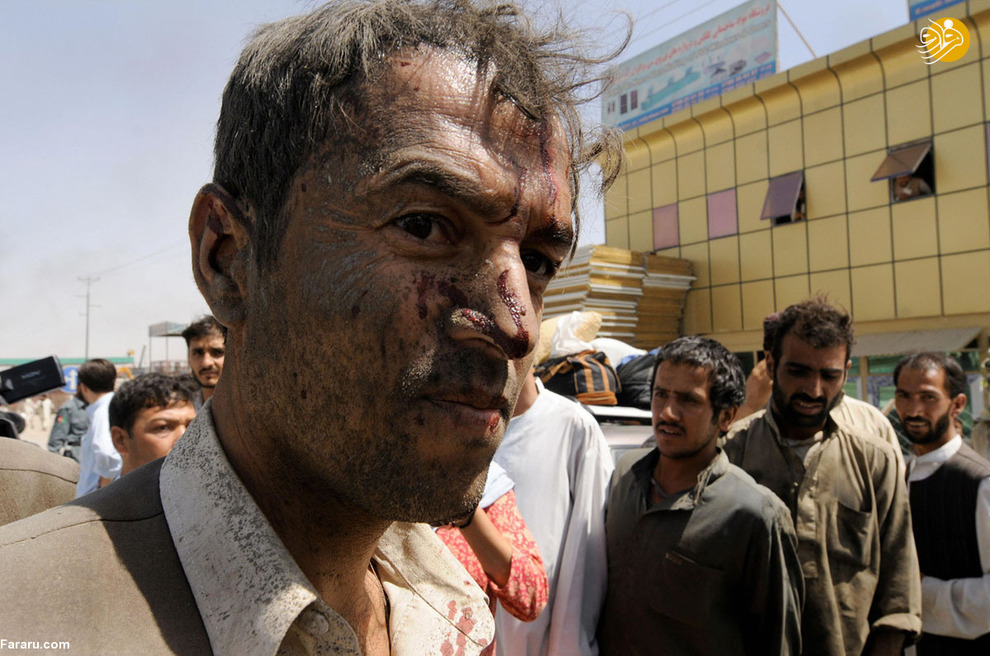 زندگی در افغانستان به روایت دوربین یک قربانی