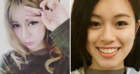 چهره دختر جوان قبل و بعد از جراحی های زیبایی