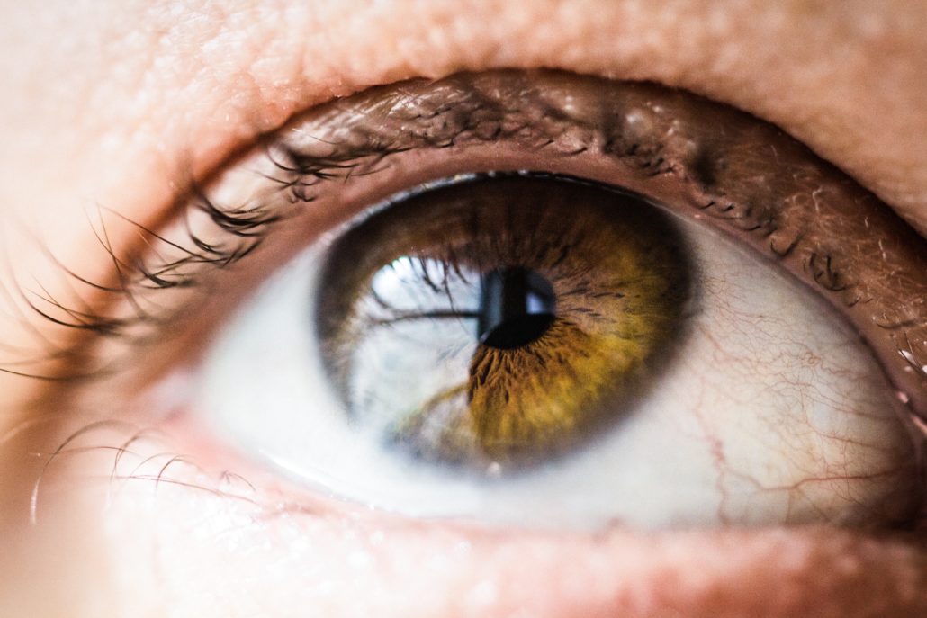 درمان سکته چشمی توسط متخصص شبکیه چشم