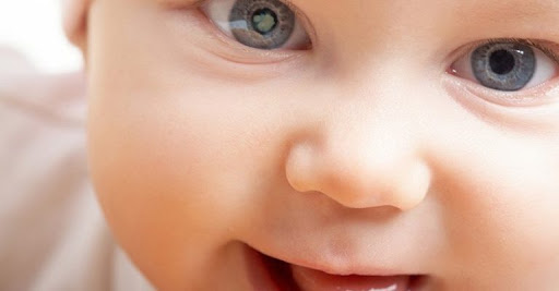 بیماری چشمی که براثر ابتلا به عفونت ها در دوران بارداری جنین را در گیر می کند