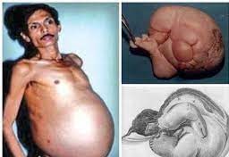 عکس مردی که حامله شد