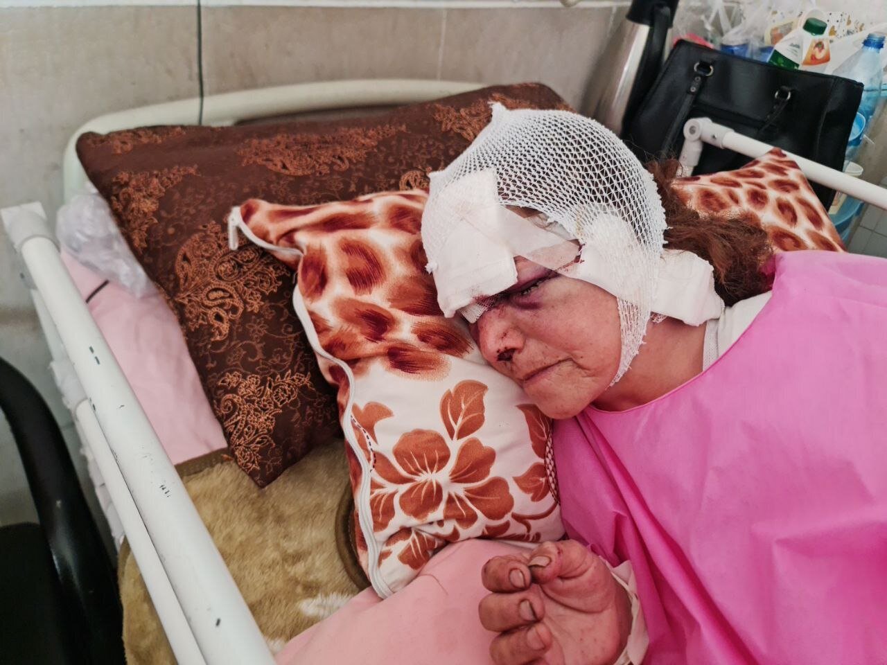 جدال زن ۶۰ ساله و خرس در ارتفاعات پیرانشهر/ روایت ماجرا از زبان پسرش+ تصویر دلخراش زن در بیمارستان