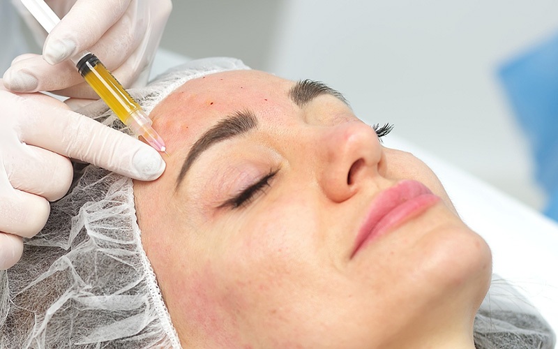 PRP و درمان لک های پوستی؛ ترکیب علم، زیبایی و سلامت پوست PRP و درمان لک های پوستی؛ ترکیب علم، زیبایی و سلامت پوست