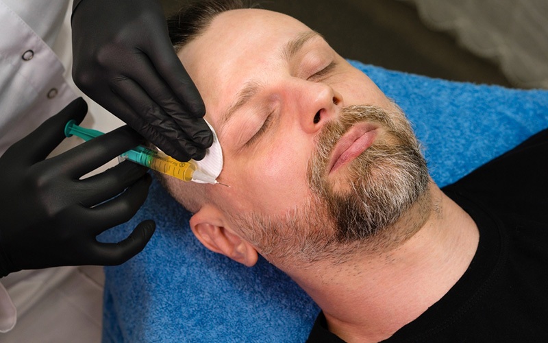 PRP و درمان لک های پوستی؛ ترکیب علم، زیبایی و سلامت پوست PRP و درمان لک های پوستی؛ ترکیب علم، زیبایی و سلامت پوست