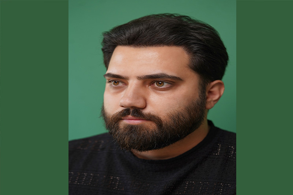 بهترین روش کاشت مو در سال 1404